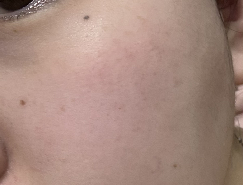 리쥬베닐 (Re-juvenil) 리페어 PDRN 크림 review image