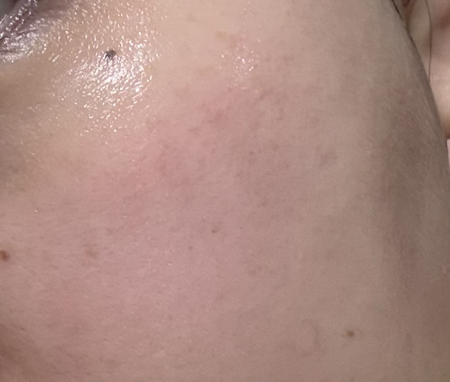 리쥬베닐 (Re-juvenil) 리페어 PDRN 크림 review image