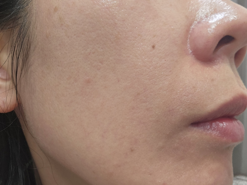 메디힐 (MEDIHEAL) 마데카소사이드 수분 선세럼 흔적 리페어 [SPF50+/PA++++] review image