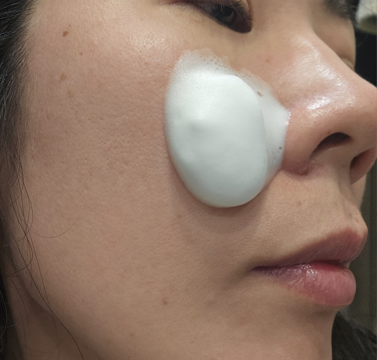 mixsoon Suero burbuja poros Hyalbae review image