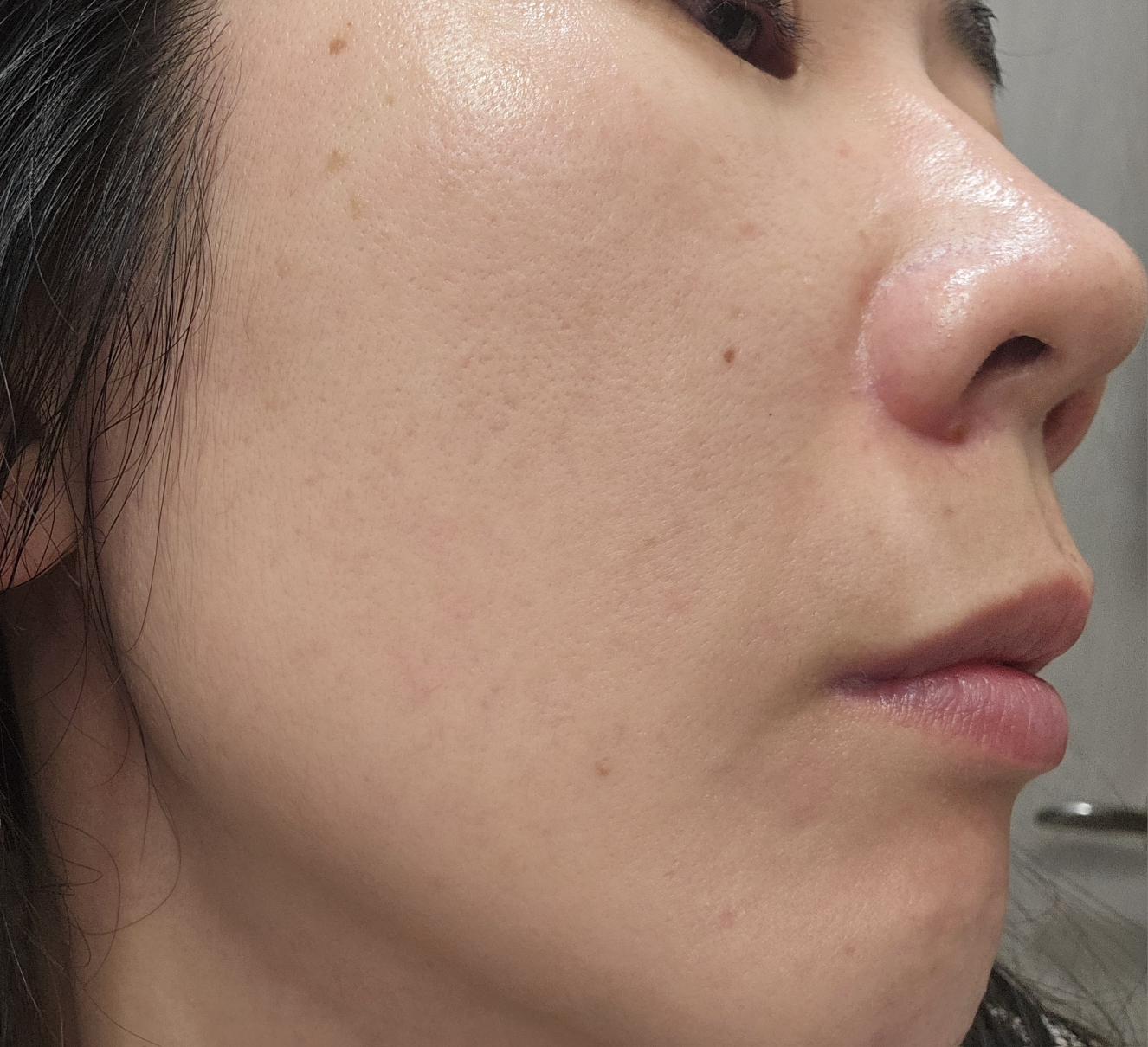 믹순 (mixsoon) 히알레배 포어 버블 세럼 review image