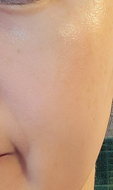 LABOREVE Tónico Fitch Microbiome 78 PDRN review image