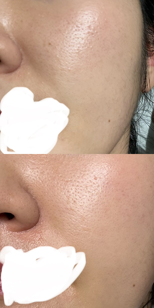 토브토브 (TOWBTOWB) 퍼펙트 콜라겐 마스크 review image