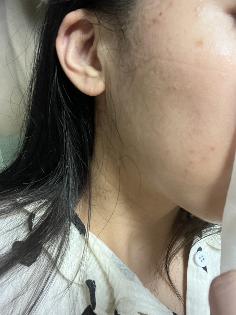 都自然 鱼腥草面膜 review image