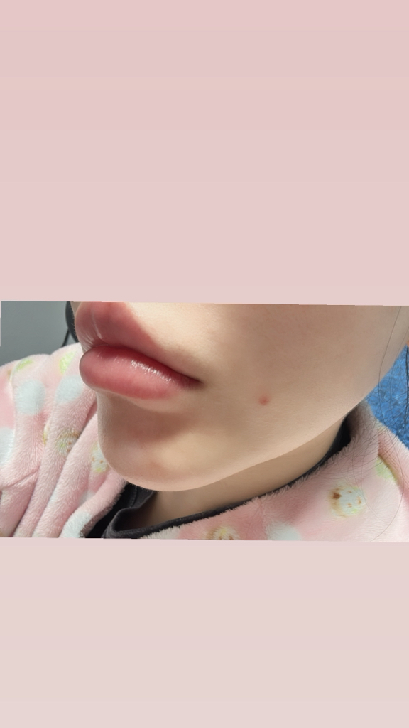 梦妆 玫瑰液体面膜 review image