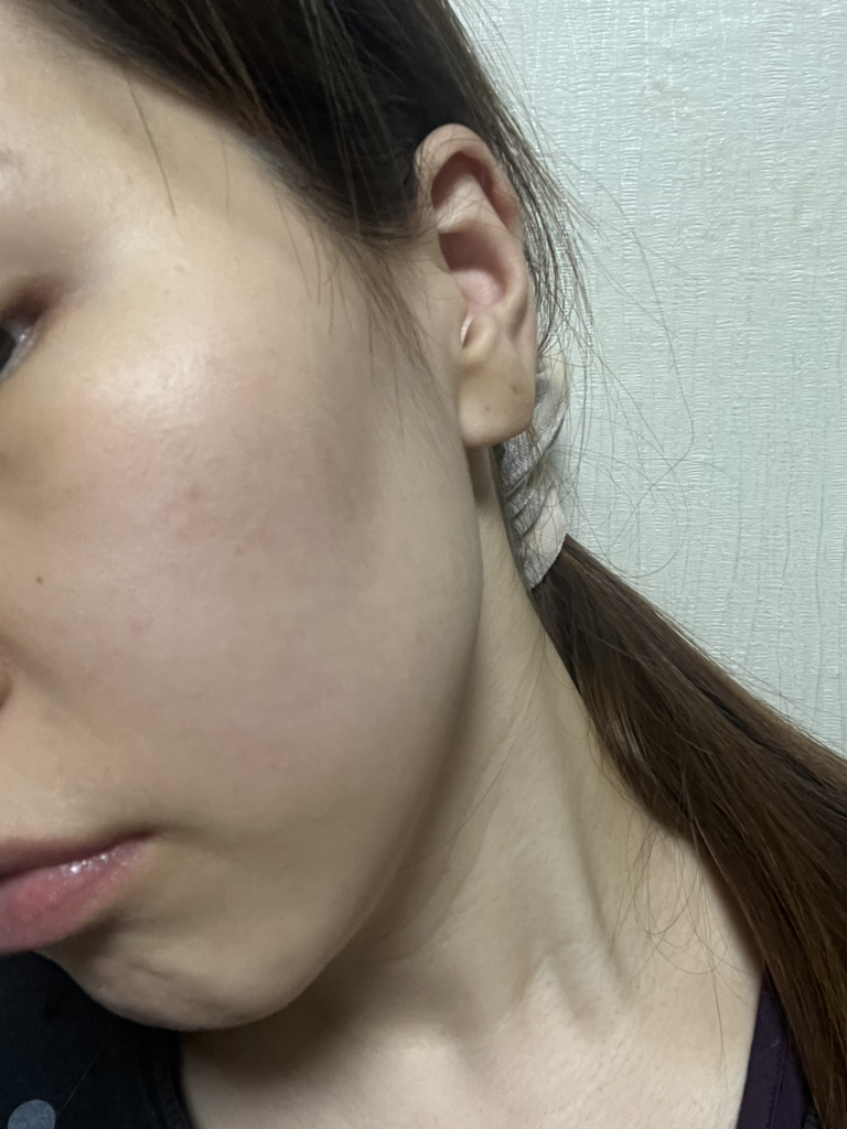 데일리유 (DAILYU) 링클프리 저분자 피쉬 콜라겐 비오틴 부스터 review image