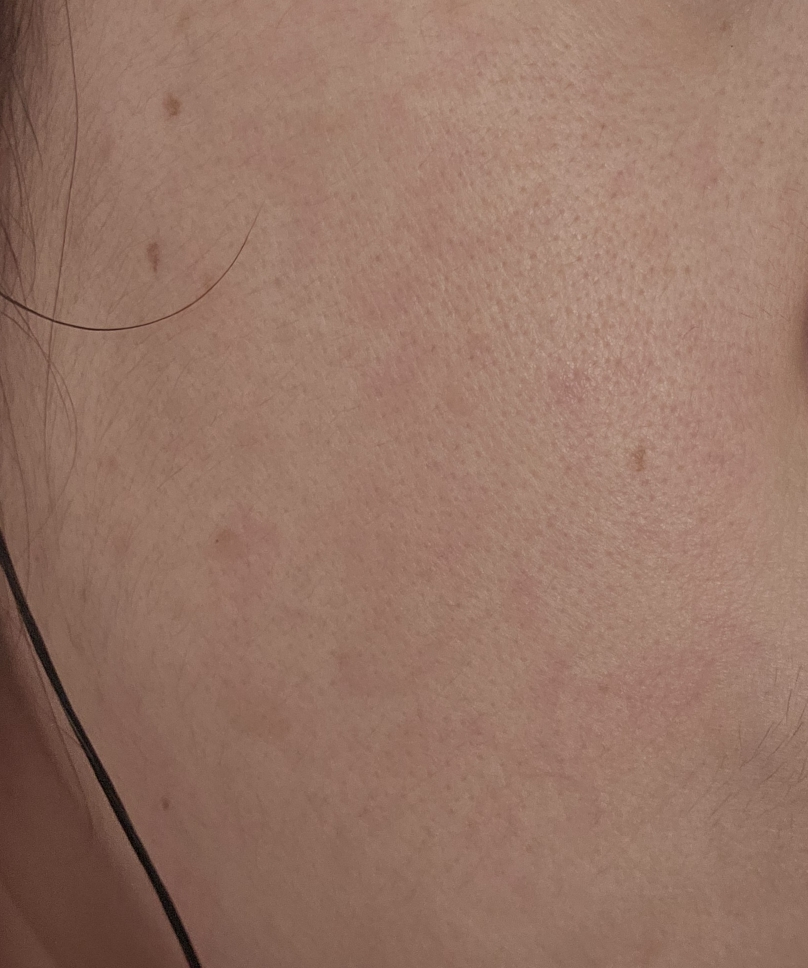 리브엠 (Reve:am) 엑소코어 텐션 앰플 [워터풀] review image