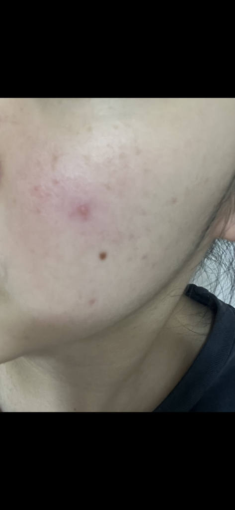 토리든 (Torriden) 다이브인 저분자 히알루론산 클렌징 폼 review image