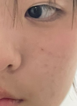 메디힐 (MEDIHEAL) 마데카소사이드 흔적 리페어 세럼 review image