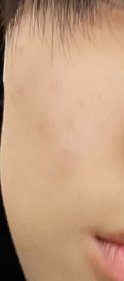 메디힐 (MEDIHEAL) 마데카소사이드 흔적 리페어 세럼 review image