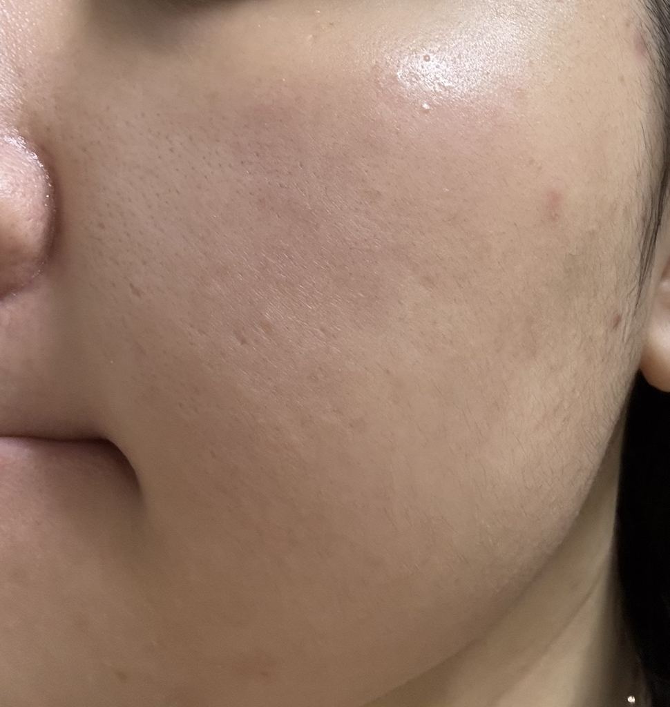 이니스프리 (INNISFREE) 레티놀 시카 흔적 앰플 review image