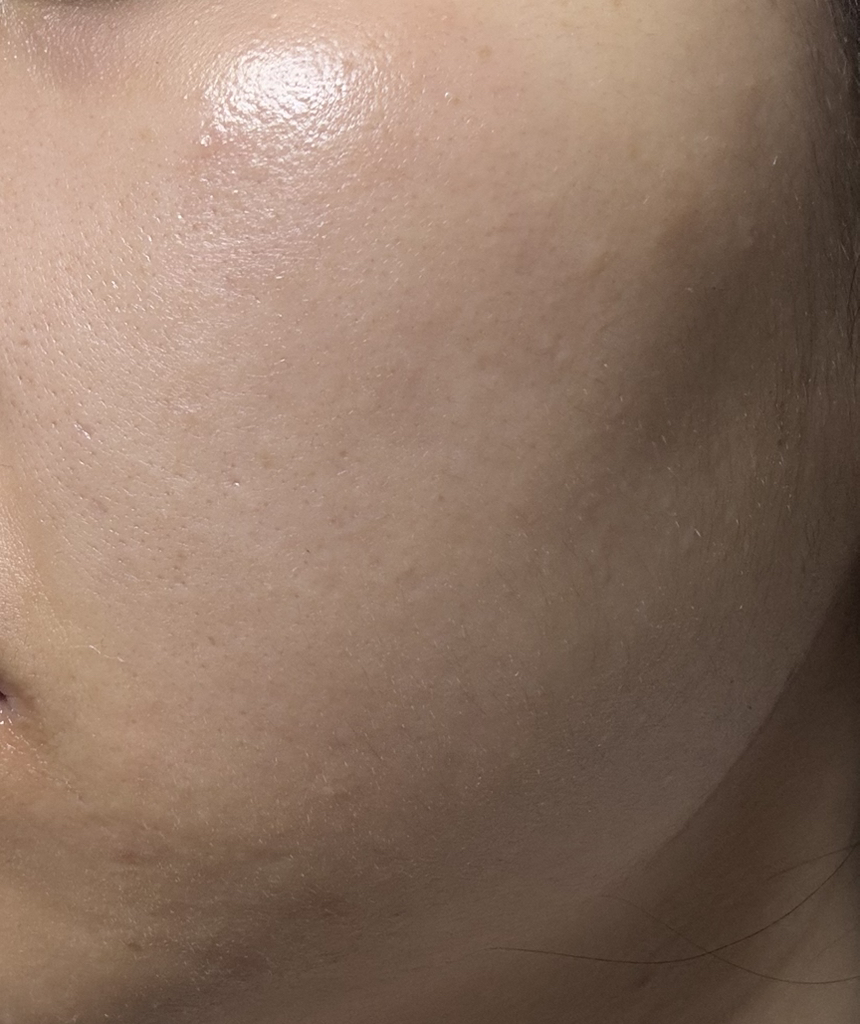 이니스프리 (INNISFREE) 레티놀 시카 흔적 앰플 review image