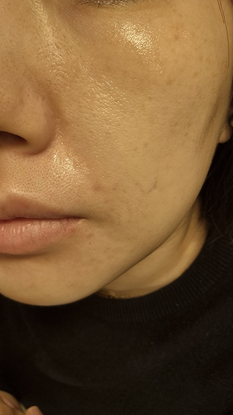 셀라딕스 (Celladix) 히알루로닉 인텐스 토너 review image