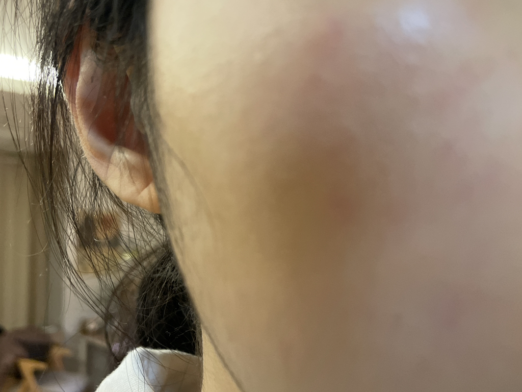 Torriden Suero de ácido hialurónico de bajo peso molecular review image