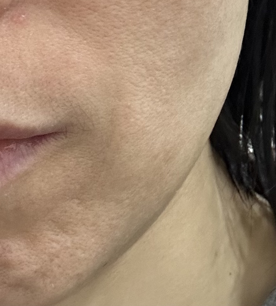 DAILYU Ringlefree Low Molecular Weight Fish Collagen Biotin Booster review image