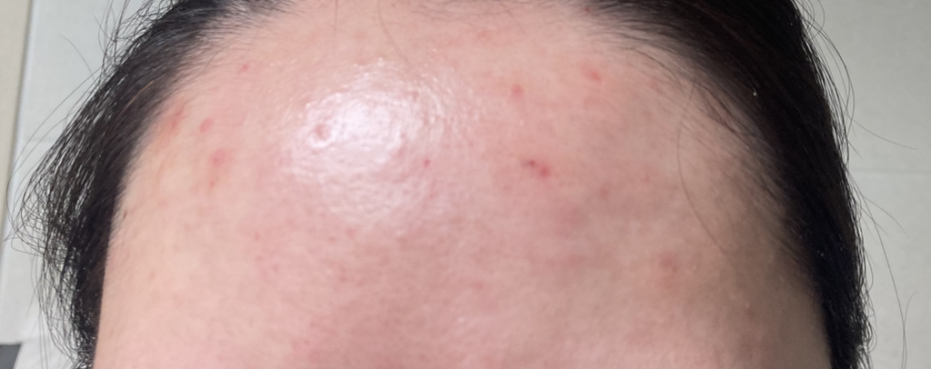 비그린 (Vegreen) 무알콜 뮤신 에센스 토너 review image