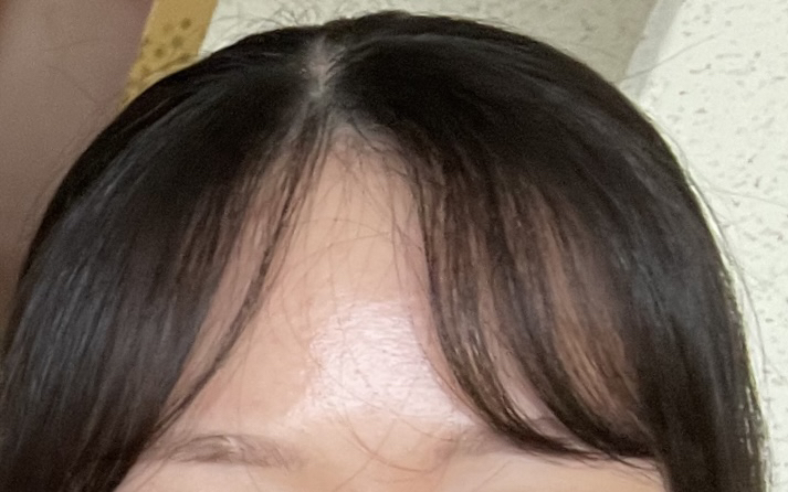 비그린 (Vegreen) 무알콜 뮤신 에센스 토너 review image