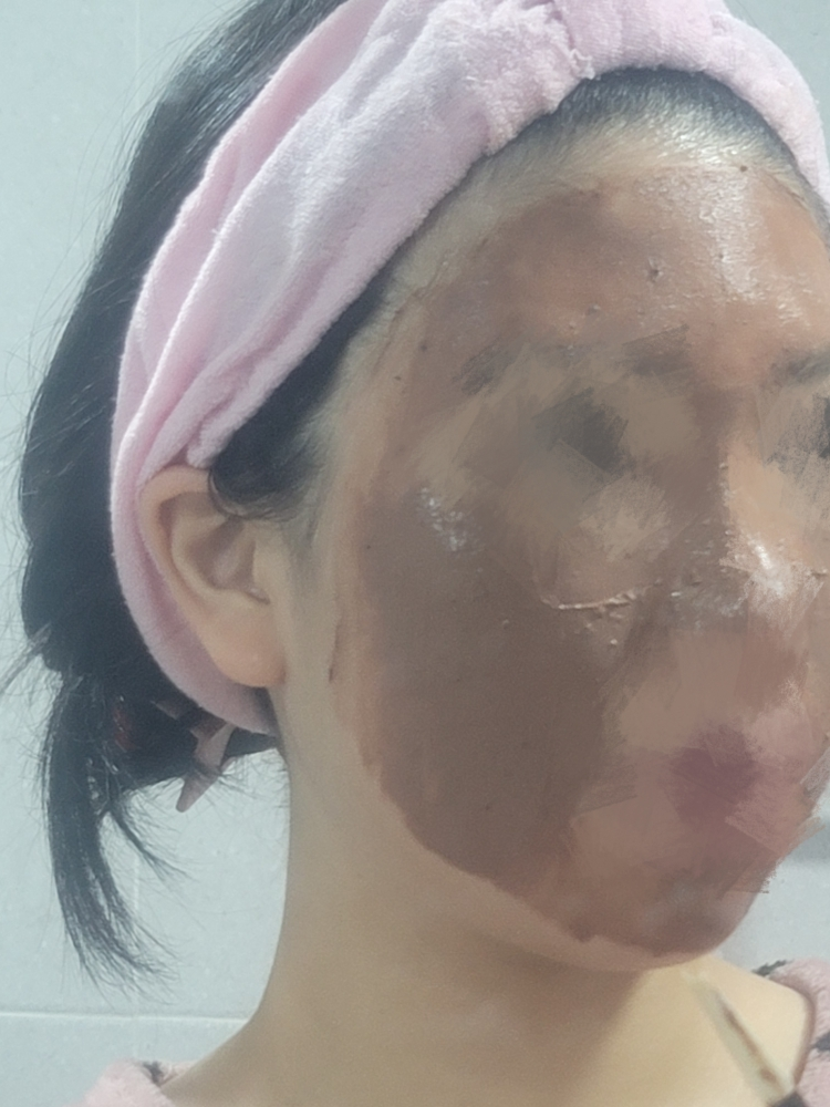 HANYUL Bálsamo de Cola de Gato Pore Pack [Limpiar la piel] review image