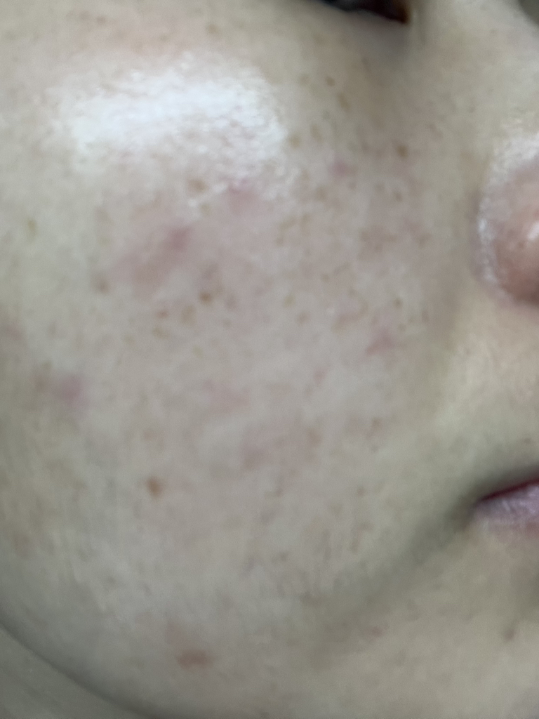 이니스프리 (INNISFREE) 레티놀 시카 흔적 앰플 review image