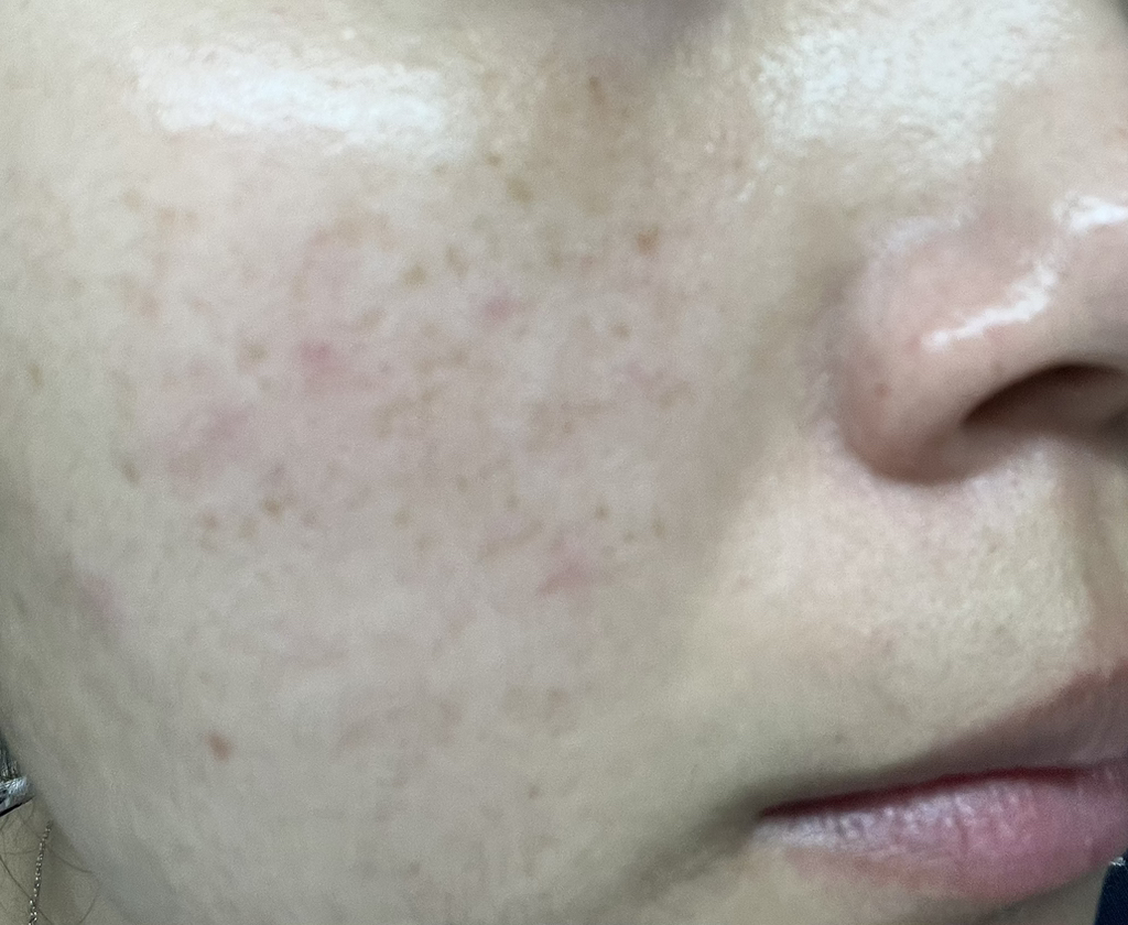 이니스프리 (INNISFREE) 레티놀 시카 흔적 앰플 review image