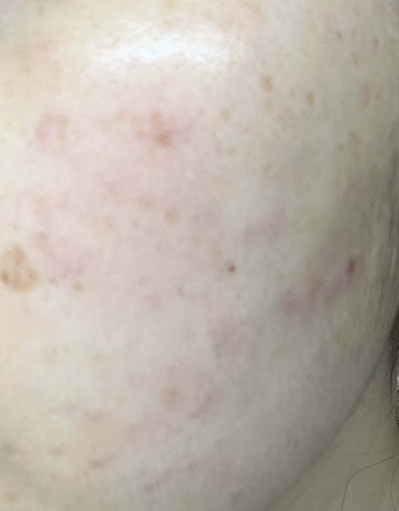 이니스프리 (INNISFREE) 레티놀 시카 흔적 앰플 review image