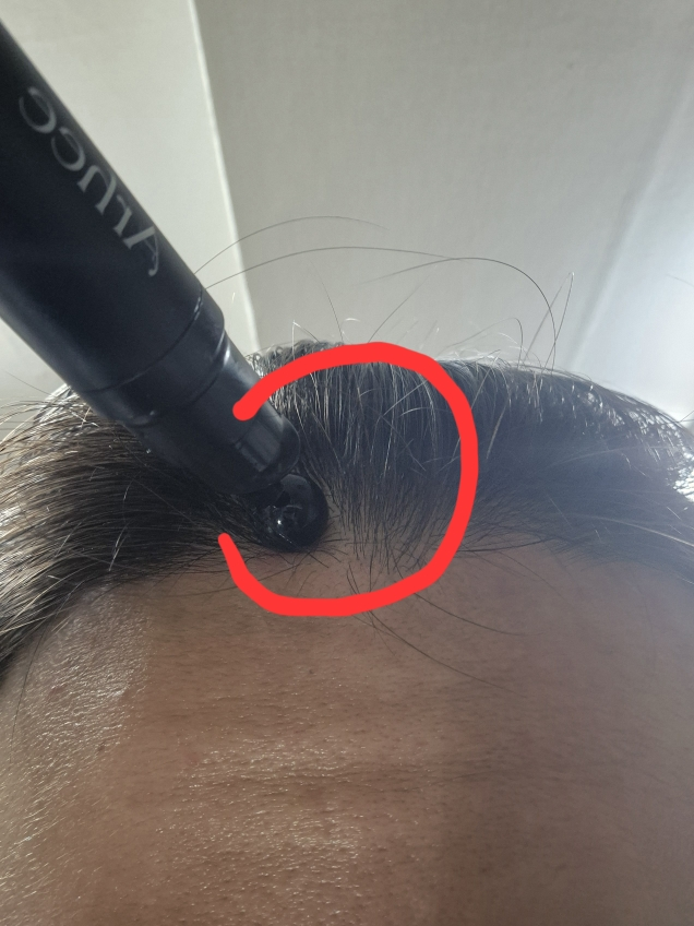 아르히 (Arhee) 스피큘 두피 앰플 review image