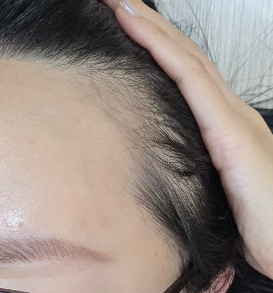 阿希 Spicule 头皮安瓿 review image