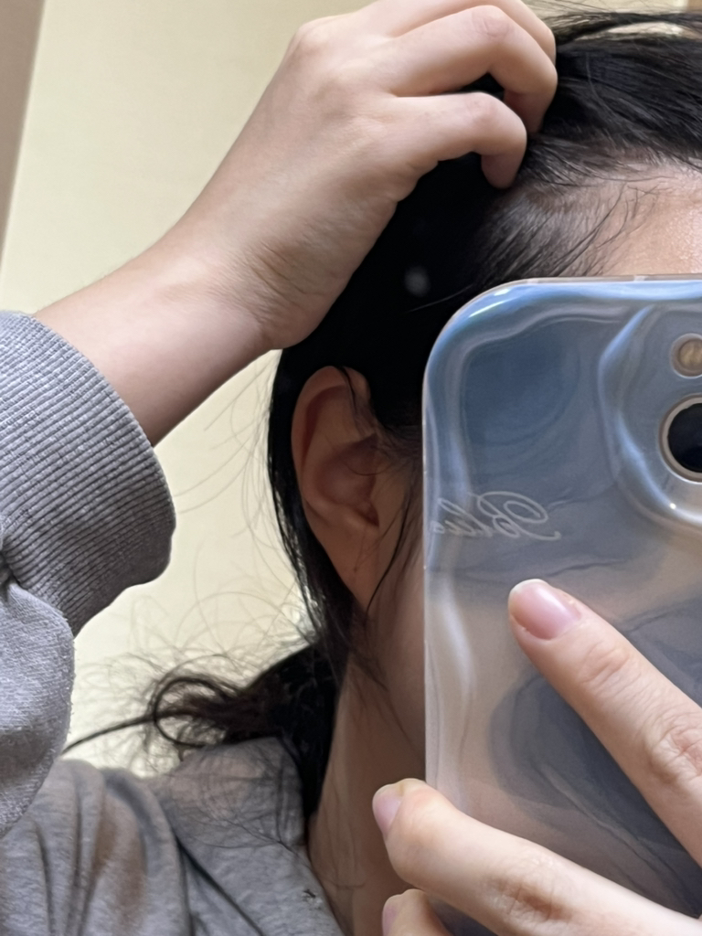 阿希 Spicule 头皮安瓿 review image