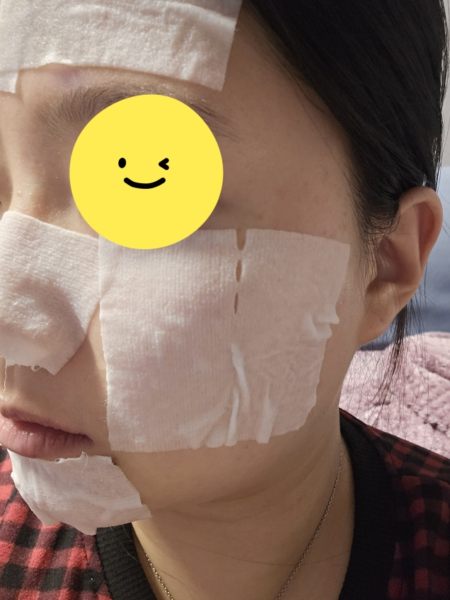 커버앤커버 (COVER&COVER) 애플민트 히알루론산 PDRN 3분 패드 팩 review image