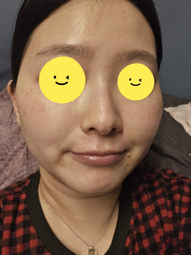 커버앤커버 (COVER&COVER) 애플민트 히알루론산 PDRN 3분 패드 팩 review image