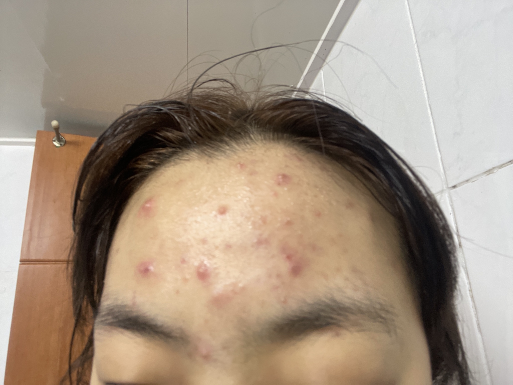 기타