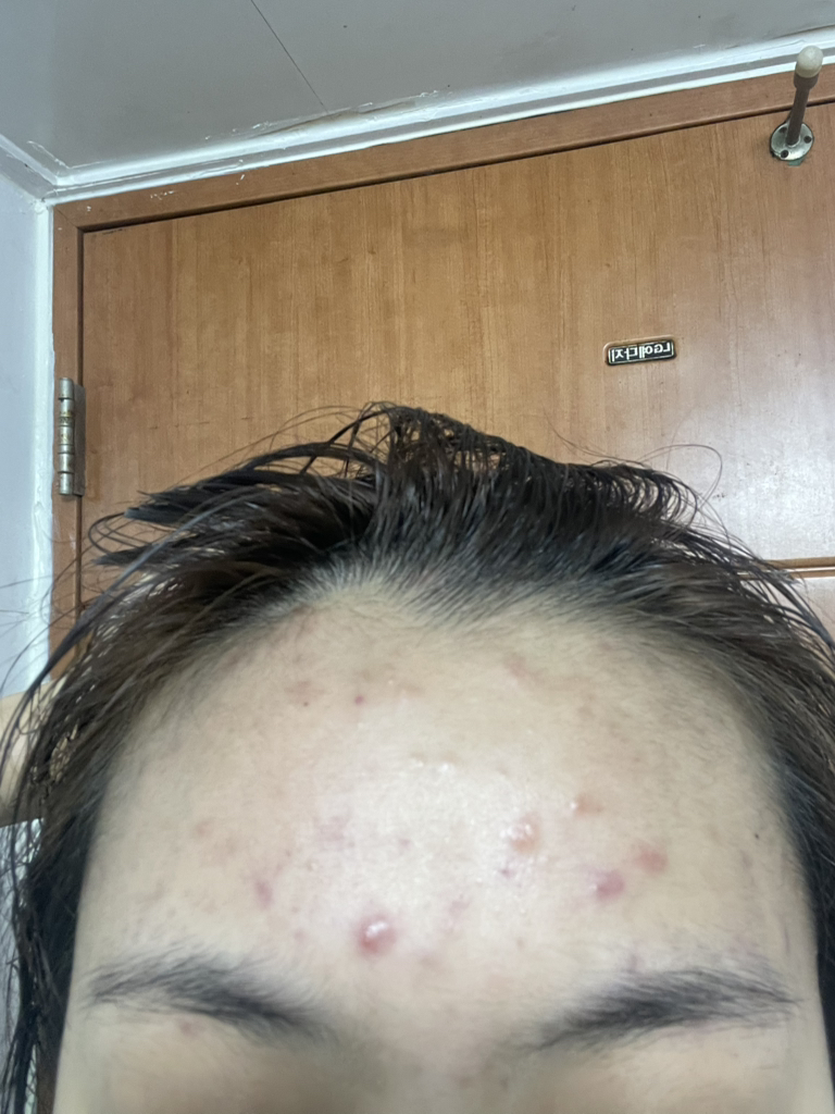 기타