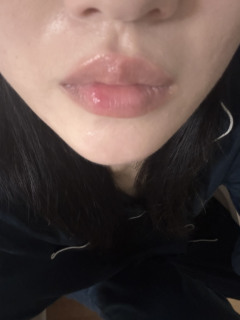 기타