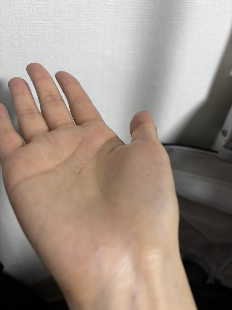기타