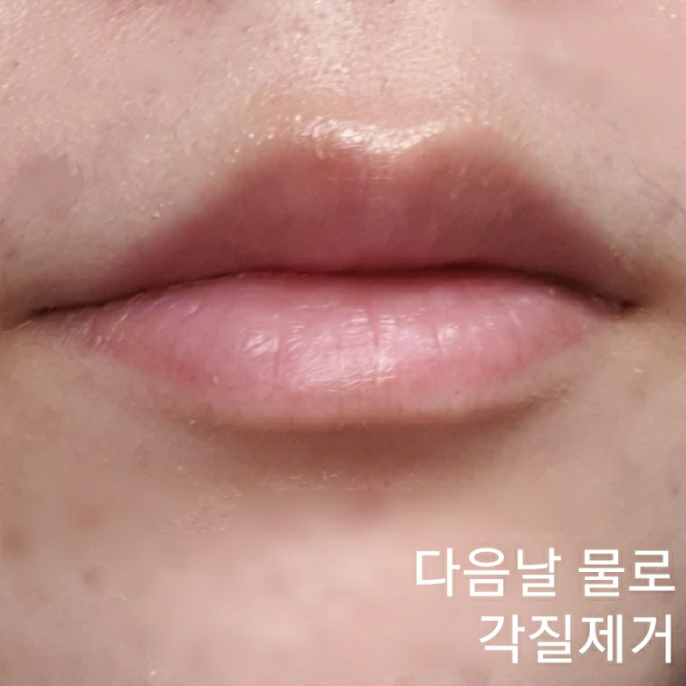 기타