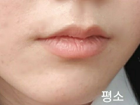 기타