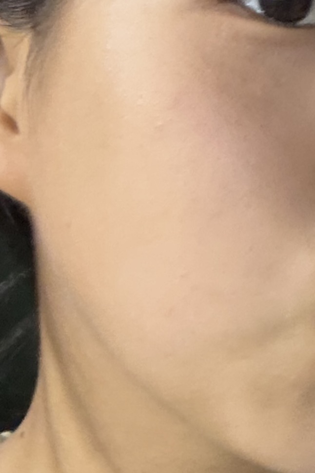 더마팩토리 (DERMAFACTORY) PDRN 4% 앰플 review image