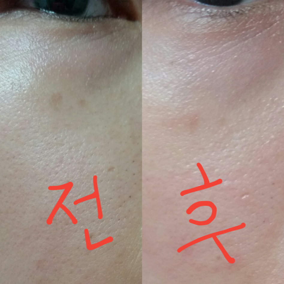 시드물 (SIDMOOL) 민중기 비타민C 32 나이트 앰플 review image