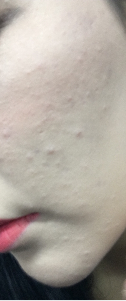 Real user review photo of BB Cushion_Pore Control [SPF50+/PA+++] [No. 13C Cool Ivory]