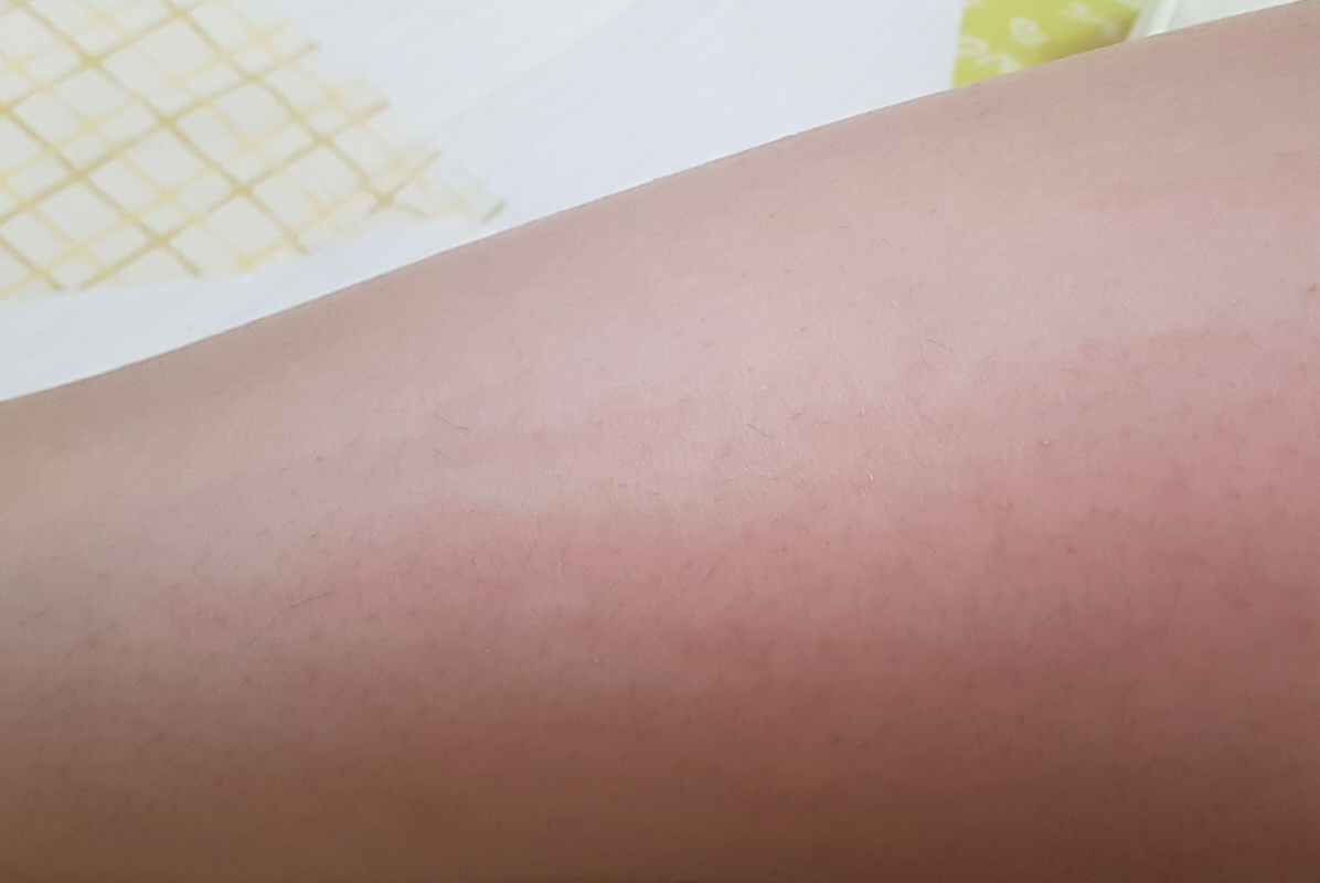 Real user review photo of Intral Soothing Cream