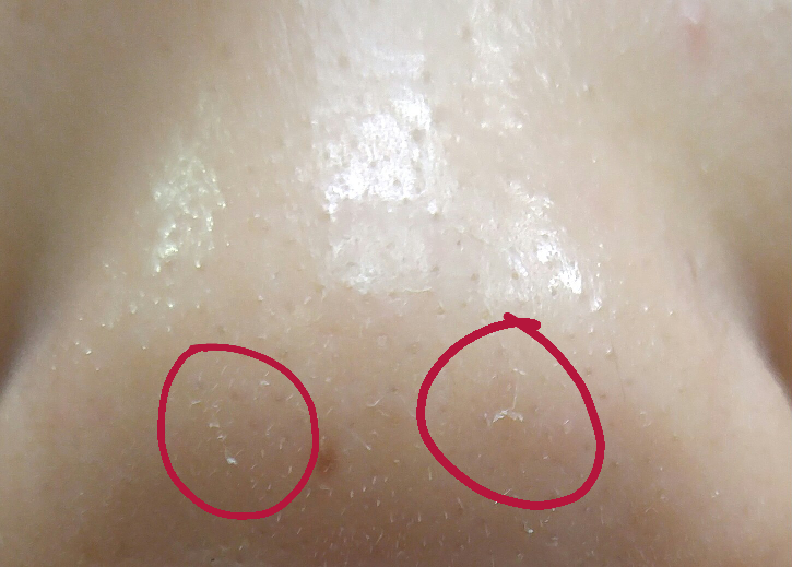 Real user review photo of Superfood Broccoli Clearing Gel Cleanser