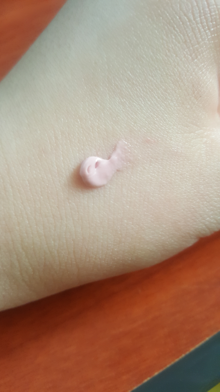 Real user review photo of red spot cream