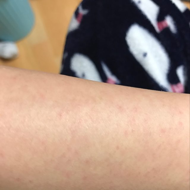 쉐어버터 제모크림 review image