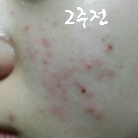 Real user review photo of Superfood Broccoli Clearing Gel Cleanser