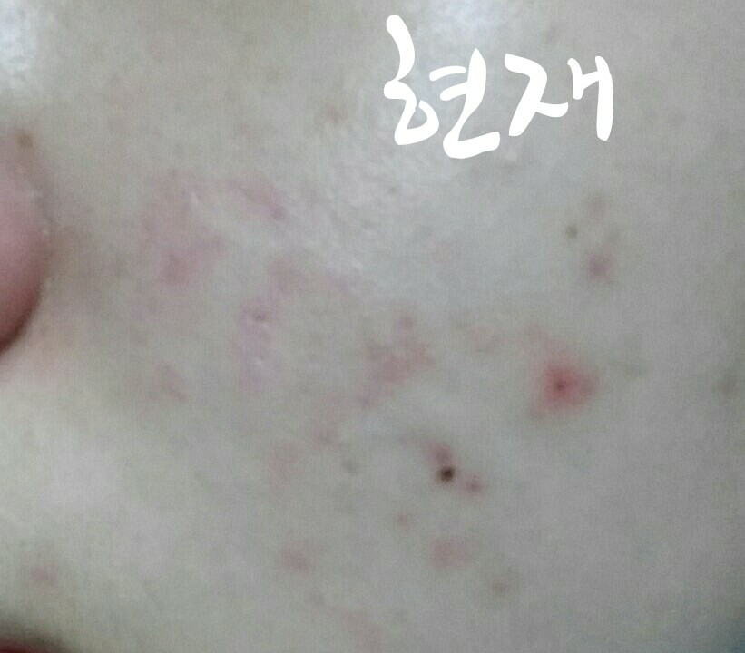 Real user review photo of Superfood Broccoli Clearing Gel Cleanser