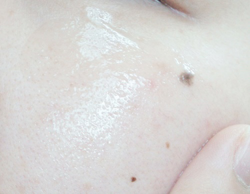 YVESOM 乳糖酵母丙烯酰胺安瓿 common.review image
