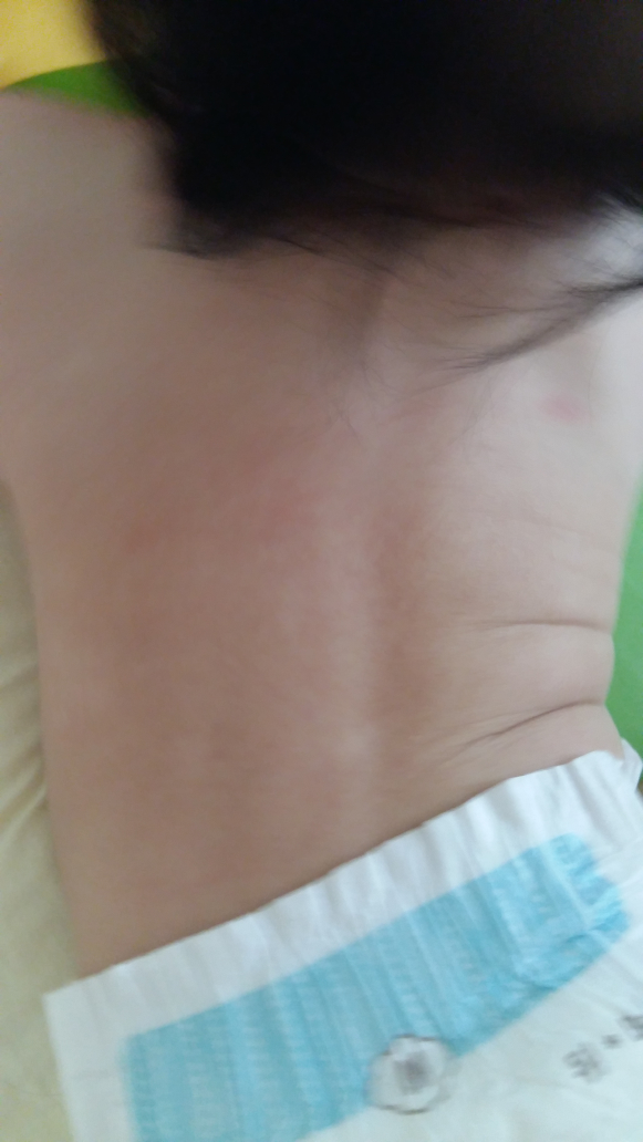 Real user review photo of Soothing Gel