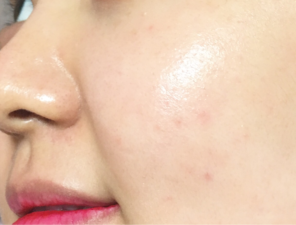 Ảnh đánh giá thực tế của người dùng về Dr. Ray Dr. Altu Real Madecassoside Booster Serum