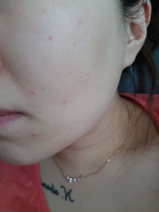Real user review photo of Moistgen Cream Skin Hydration