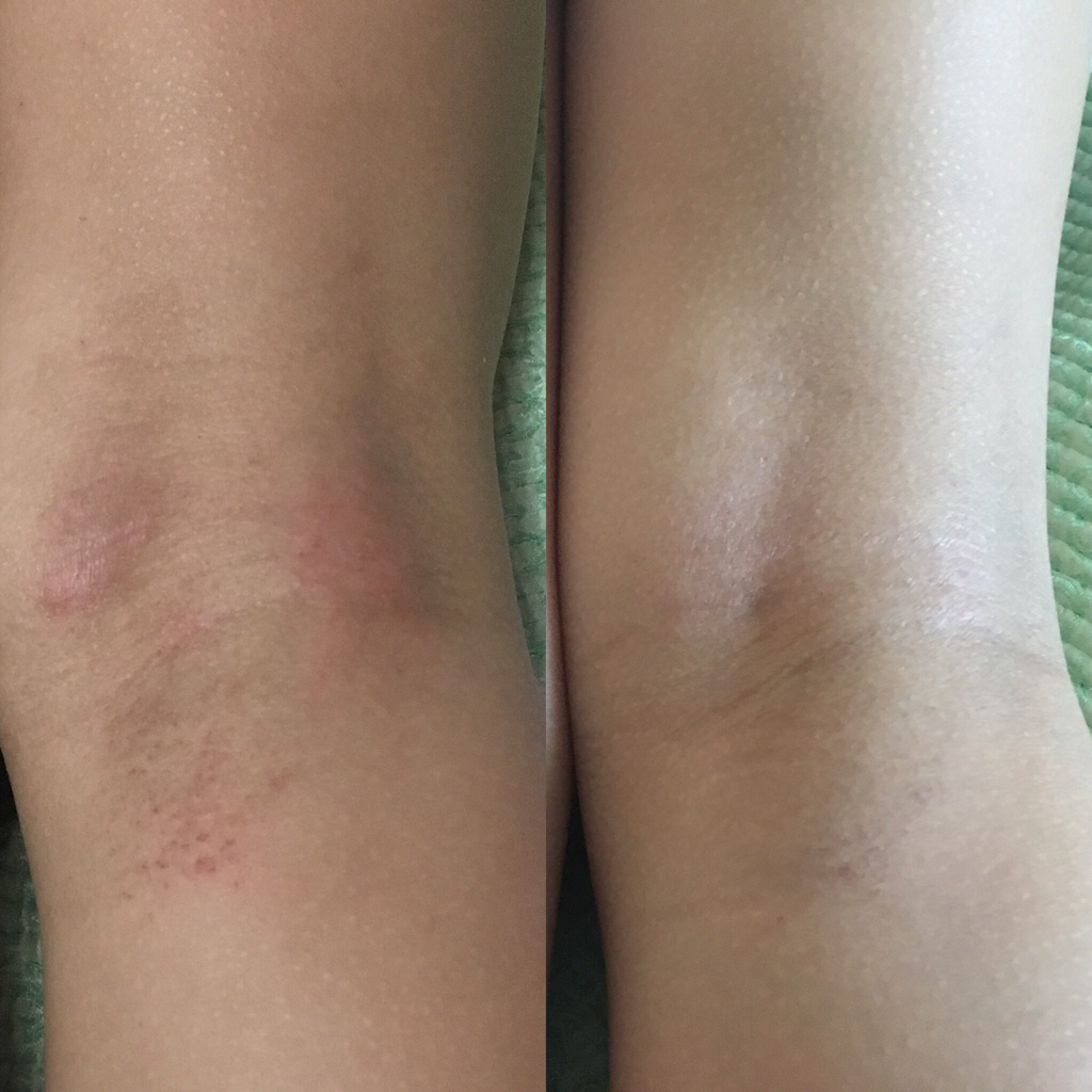 婴儿阿托霜的真实用户使用照片